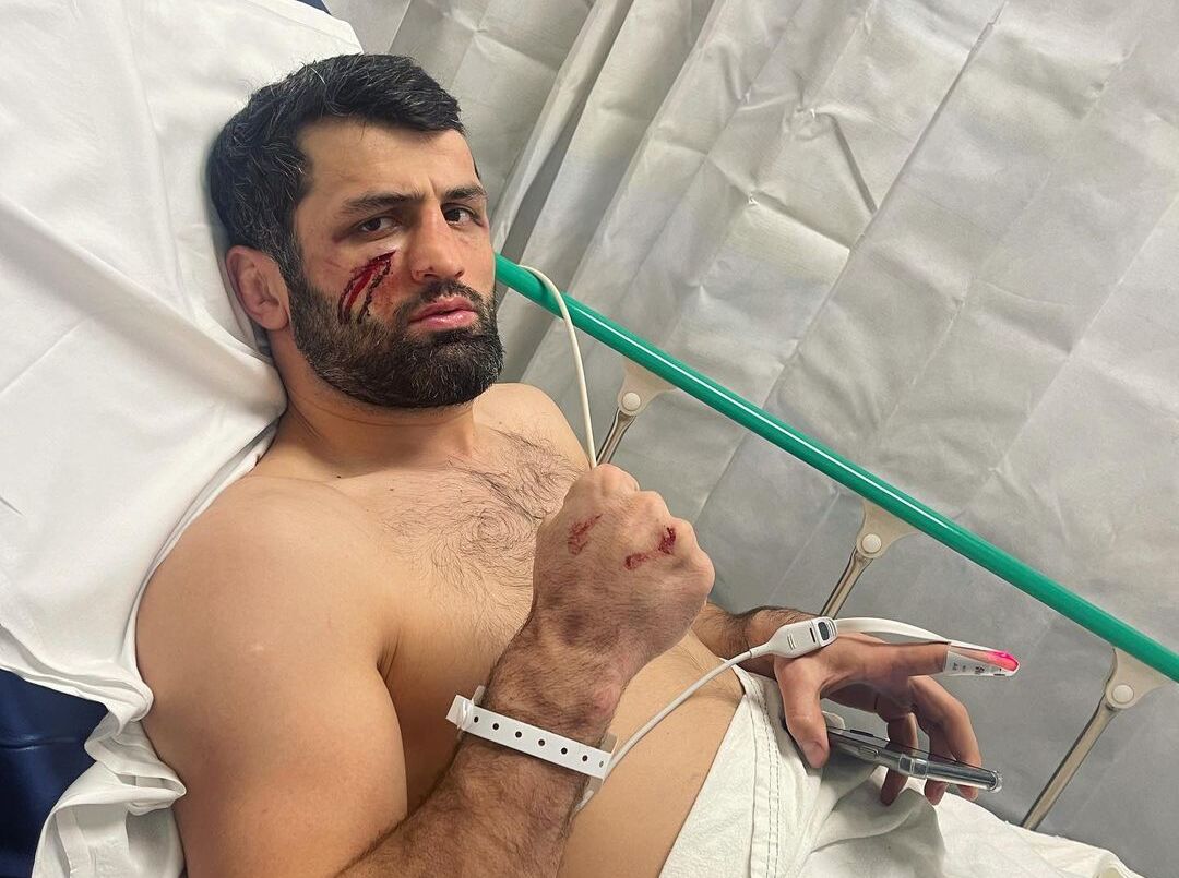 Россиянин Омаргаджиев попал в больницу после запрещенного удара коленом в UFC